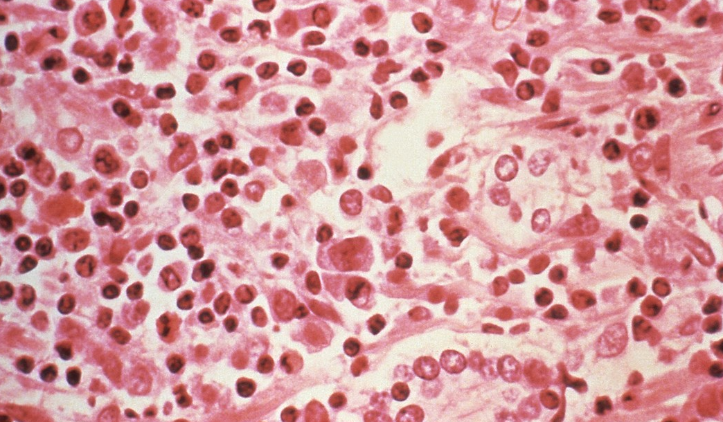 Expertos alertan que frenar contagios humanos es clave para evitar evolución del hantavirus andino