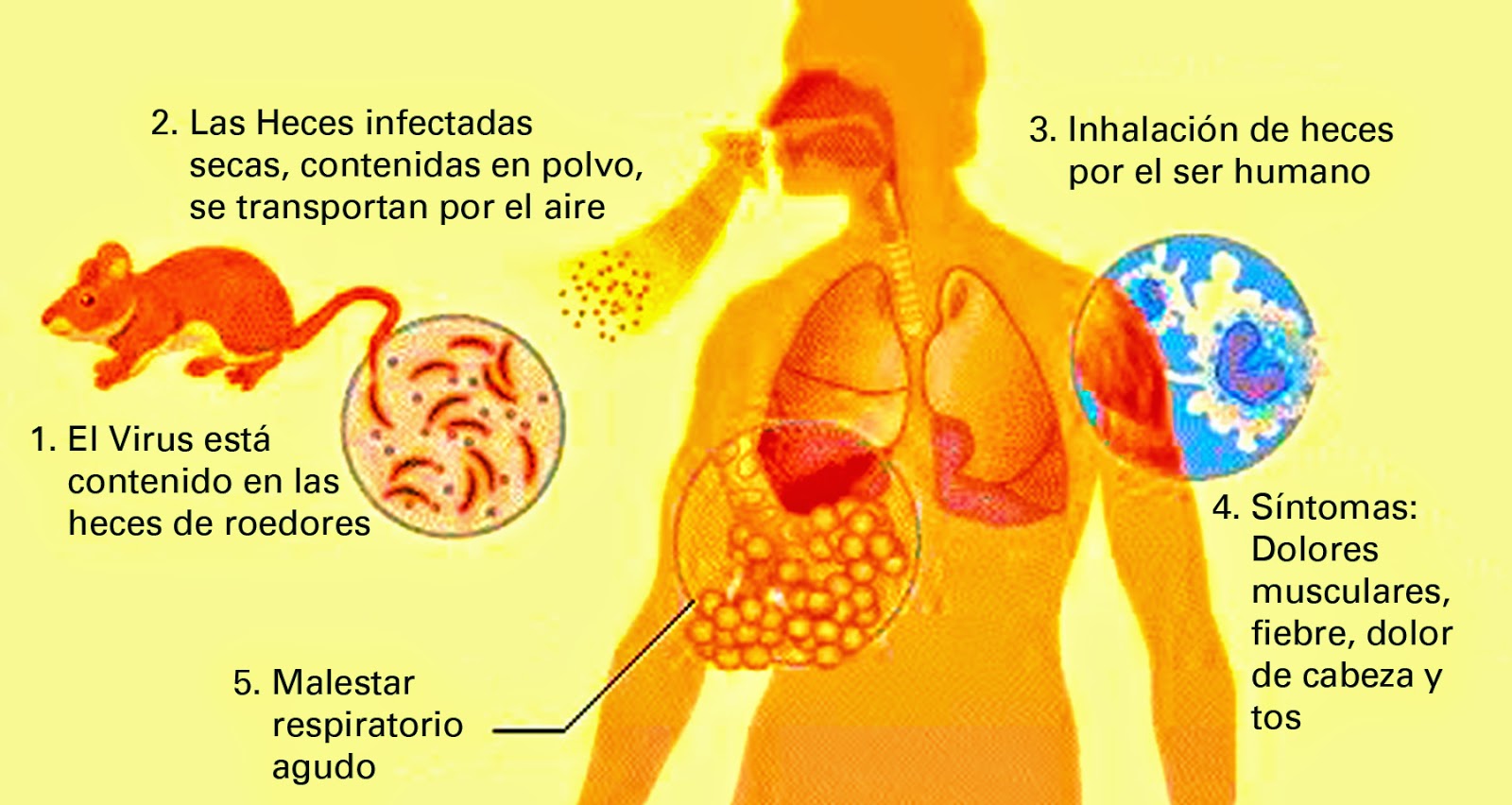 Fallece un paciente de la inusual fiebre de Lassa en un hospital británico 1 5 15