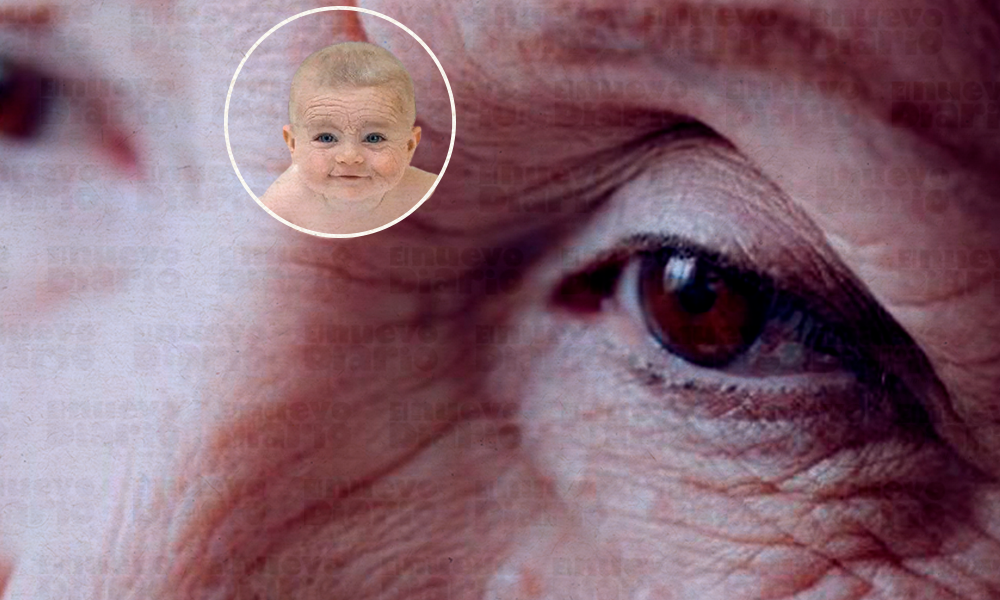 Nueva diana para tratar las enfermedades del envejecimiento prematuro 1 Enjvecimiento prematuro