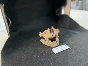 Odontología forense