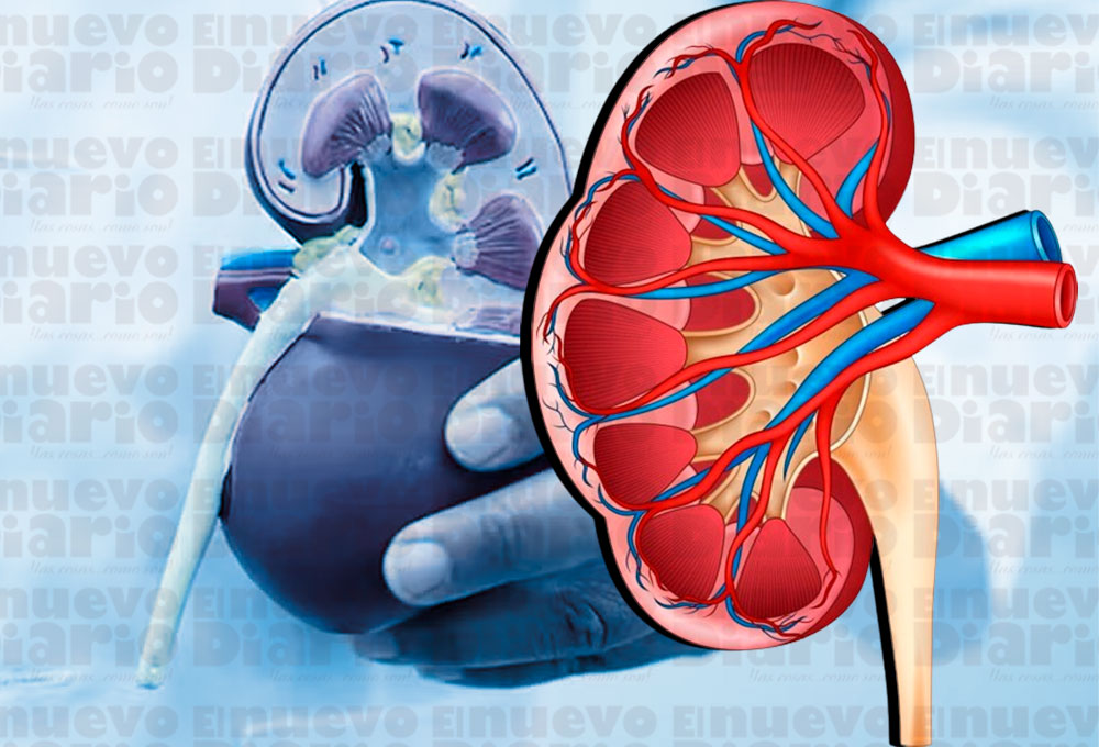 Día Mundial del Riñón: una conmemoración para crear conciencia sobre la ...