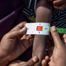 Uno de cada cuatro niños en el mundo sufre pobreza alimentaria grave, según UNICEF