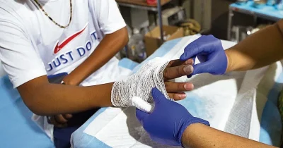 En el período del 12 al 29 de diciembre del año en curso, también figuran 25 personas quemadas con edades entre 10 y 18 años