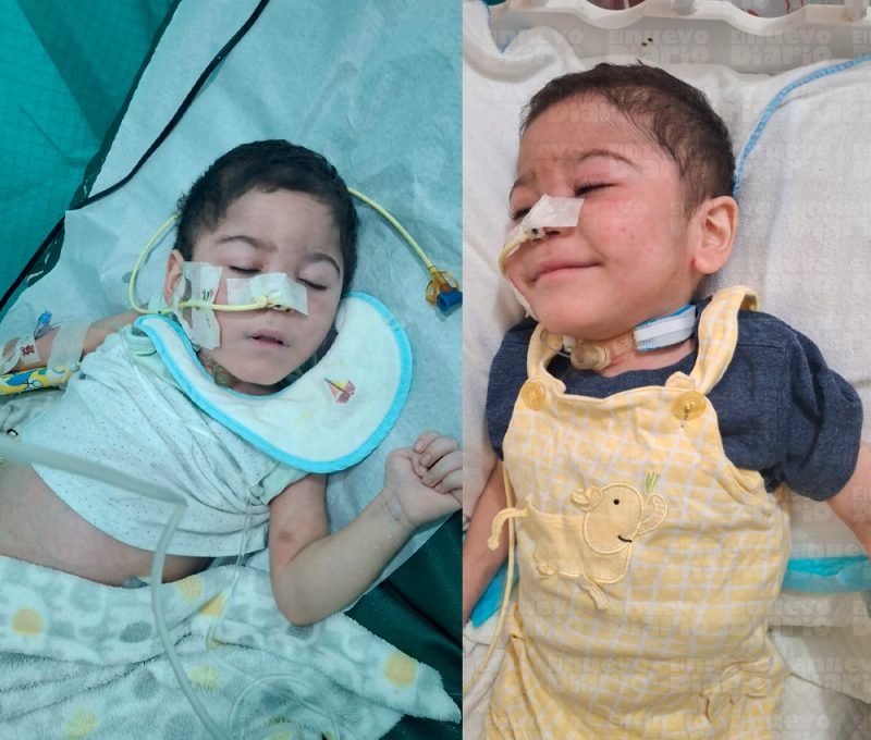 La dura batalla del pequeño trillizo Nicolás Viloria Mejía, de apenas dos años/END.