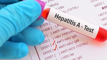 Cuba descarta epidemia de hepatitis A, pero admite grave crisis sanitaria y escasez de medicamentos