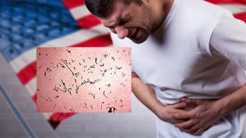 Instan neoyorkinos tomar precauciones adicionales con productos infesta el intestino delgado