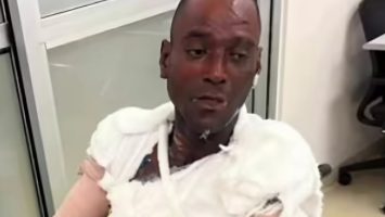 Hombre es quemado con agua caliente en Samaná