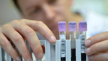 Hepatitis C puede curarse en 95 % de casos, pero mexicanos lo desconocen